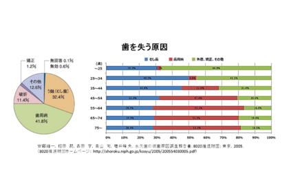 歯を失う原因は？