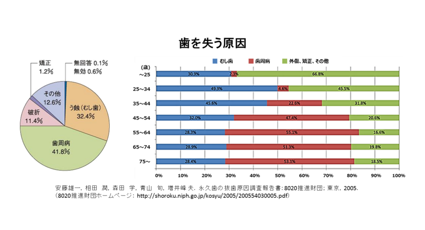 歯を失う原因は？