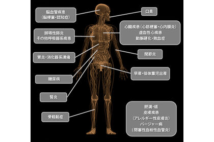 歯周病と全身疾患