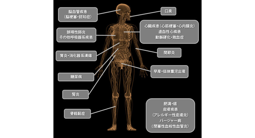 歯周病と全身疾患