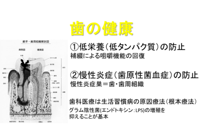 歯の予防医療