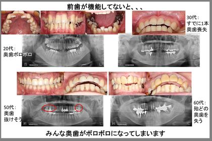 前歯の機能・犬歯の役割と奥歯の関係