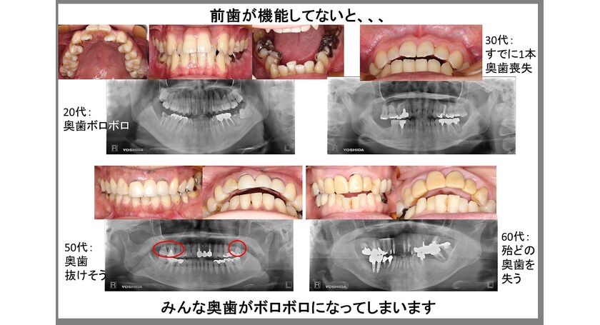 前歯の機能・犬歯の役割と奥歯の関係