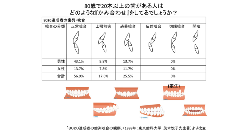 現在、歯並び・噛み合わせが悪いと…歯を失う未来が確定的？_