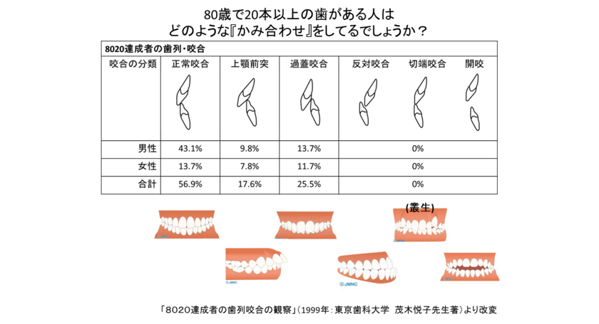 前歯の役割と歯の寿命